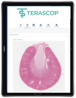 Aperçu du visualiseur de lames scannées de Terascop sur tablette